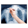 Edding 8010 x-ray marker wit (0,8 mm rond) 4-8010049 239197 - 3